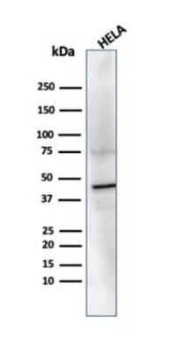 Western Blot: PRMT7 Antibody (PCRP-PRMT7-1A4) [NBP3-13741] - Western blot analysis of HeLa cell lysate using PRMT7 antibody (PCRP-PRMT7-1A4).