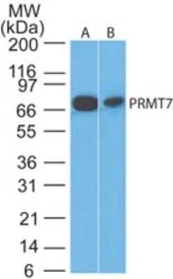 Western Blot: PRMT7 Antibody [NB100-56400] - Analysis of PRMT7 in A) HeLa and B) NIH 3T3 cell lysate using this antibody at 2 ug/ml.