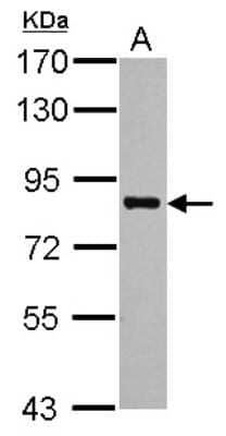 Western Blot: PRMT7 Antibody [NBP2-19938] - Sample (30 ug of whole cell lysate) A: NT2D1 7. 5% SDS PAGE gel, diluted at 1:1000.