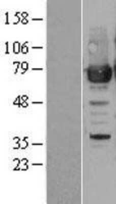 Western Blot PRMT7 Overexpression Lysate