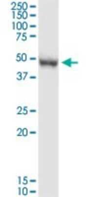 Western Blot: PRMT8 Antibody [H00056341-D01P] - Analysis of PRMT8 expression in human colon.