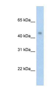 Western Blot: PRMT8 Antibody [NBP1-55401] - Transfected 293T cell lysate, concentration 2.5 ug/ml.