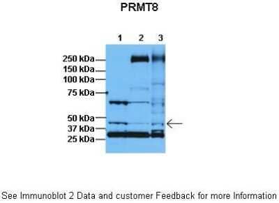 Western Blot: PRMT8 Antibody [NBP1-55401] - Lanes: 1 : 30ug HeLa lysate , 2: 30ug HFF lysate , 3: 30ug U2OS lysate Primary, Antibody Dilution: 1 : 1000 Secondary Antibody: Anti-rabbit HRP Secondary, Antibody Dilution: 1 : 5000 Gene name: PRMT8.