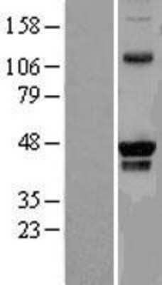 Western Blot: PRMT8 Overexpression Lysate (Adult Normal) [NBL1-14798] Left-Empty vector transfected control cell lysate (HEK293 cell lysate); Right -Over-expression Lysate for PRMT8.