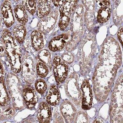 Immunohistochemistry-Paraffin: PRODH Antibody [NBP1-92288] - Staining of human kidney shows strong cytoplasmic positivity in cells in tubules.