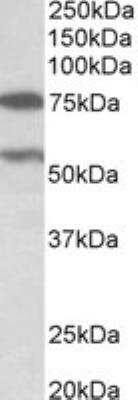 Western Blot: PRODH Antibody [NBP2-27548] - (0.3 ug/ml) Analysis of Human Cerebellum lysate (35 ug protein in RIPA buffer). Primary incubation was 1 hour. Detected by chemiluminescence.