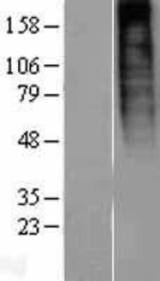 Western Blot: PROKR1 Overexpression Lysate (Adult Normal) [NBP2-04419] Left-Empty vector transfected control cell lysate (HEK293 cell lysate); Right -Over-expression Lysate for PROKR1.