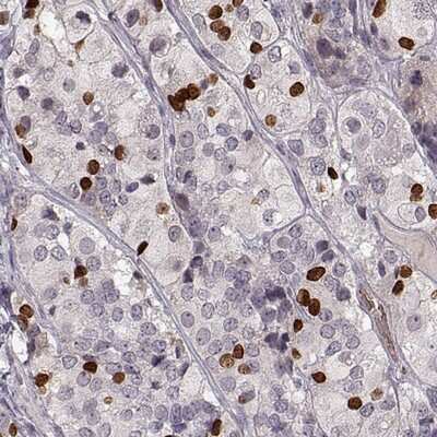 Immunohistochemistry-Paraffin: PROP1 Antibody [NBP2-68688] - Staining of human anterior pituitary gland shows strong nuclear positivity.