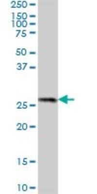 Western Blot: PROSC Antibody [H00011212-B01P] - Analysis of PROSC expression in human liver.
