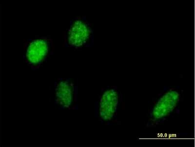 Immunocytochemistry/Immunofluorescence: PRP18 Antibody [H00008559-B02P] - Analysis of purified antibody to PRPF18 on HeLa cell. (antibody concentration 10 ug/ml)