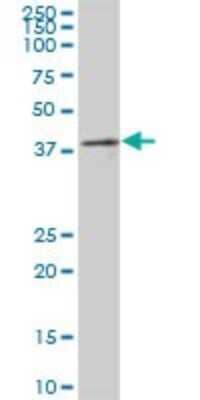 Western Blot PRP18 Antibody