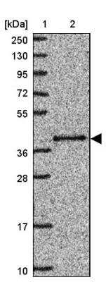 Western Blot PRP18 Antibody