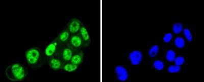Immunocytochemistry/Immunofluorescence: PRP19 Antibody (SC06-53) [NBP2-67597] - Staining PRP19 in MCF-7 cells (green). The nuclear counter stain is DAPI (blue). Cells were fixed in paraformaldehyde, permeabilised with 0.25% Triton X100/PBS.