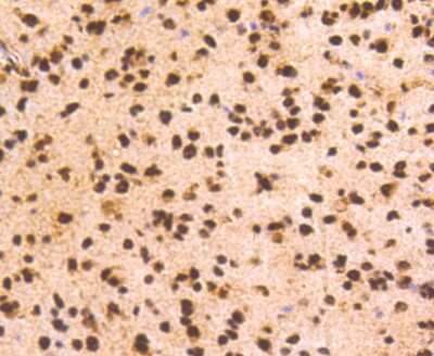 Immunohistochemistry-Paraffin: PRP19 Antibody (SC06-53) [NBP2-67597] - Analysis of paraffin-embedded mouse brain tissue using anti-PRP19 antibody. Counter stained with hematoxylin.