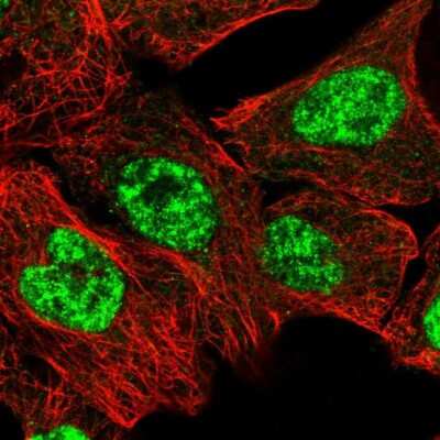 Immunocytochemistry/Immunofluorescence: PRPF3 Antibody [NBP1-83219] - Immunofluorescent staining of human cell line A-431 shows localization to nuclear speckles.