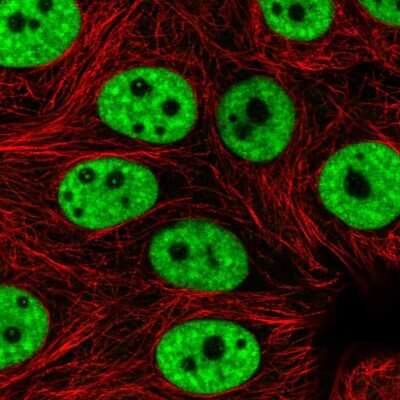 Immunocytochemistry/Immunofluorescence: PRPF3 Antibody [NBP2-57826] - Staining of human cell line MCF7 shows localization to nuclear speckles.