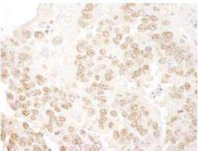 Immunohistochemistry-Paraffin: PRPF3 Antibody [NBP1-19114] - FFPE section of mouse teratoma.  Affinity purified rabbit anti-hPrp3p used at a dilution of 1:100.