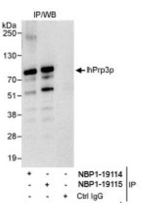 Immunoprecipitation: PRPF3 Antibody [NBP1-19114] - Whole cell lysate (1 mg for IP, 20% of IP loaded) from HeLa cells. NBP1-19114 used for IP at 3 mcg/mg lysate.  hPrp3p was also immunoprecipitated by NBP1-19115 which recognizes a downstream epitope