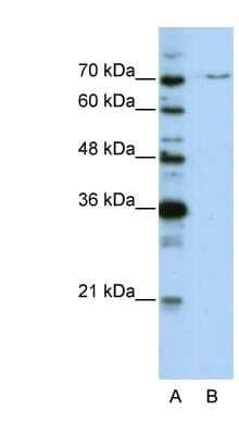 Western Blot: PRPF3 Antibody [NBP1-57201] - HepG2 cell lysate, concentration 0.2-1 ug/ml.