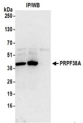 Immunoprecipitation: PRPF38A Antibody [NBP2-37697] - Whole cell lysate (0.5 or 1.0 mg per IP reaction; 20% of IP loaded) from 293T cells prepared using NETN lysis buffer.   Affinity purified rabbit anti-PRPF38A antibody used for IP at 6 ug per reaction.  PRPF38A was also immunoprecipitated by rabbit anti-PRPF38A antibody.  For blotting immunoprecipitated PRPF38A, was used at 1 ug/ml.  Detection: Chemiluminescence with an exposure time of 30 seconds.
