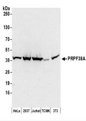 Western Blot: PRPF38A Antibody [NBP2-37697] - Whole cell lysate (50 ug) from HeLa, 293T, Jurkat, mouse TCMK-1, and mouse NIH3T3 cells prepared using NETN lysis buffer.   Affinity purified rabbit anti-PRPF38A antibody  used for WB at 0.1 ug/ml.  Detection: Chemiluminescence with an exposure time of 30 seconds.