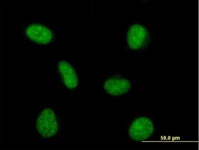 Immunocytochemistry/Immunofluorescence: PRPF4 Antibody [H00009128-B01P] - Analysis of purified antibody to PRPF4 on HeLa cell. (antibody concentration 10 ug/ml)