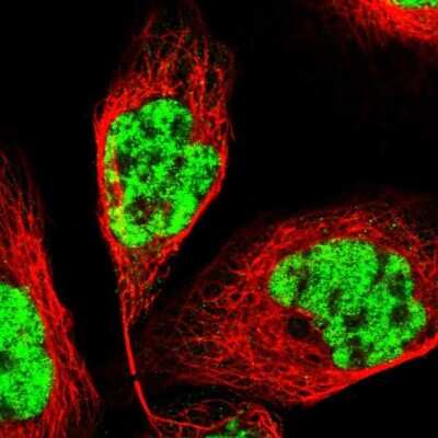 Immunocytochemistry/Immunofluorescence: PRPF4 Antibody [NBP1-83217] - Staining of human cell line A-431 shows localization to nuclear speckles.