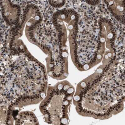 Immunohistochemistry-Paraffin: PRPF4 Antibody [NBP1-83217] - Staining of human duodenum shows strong cytoplasmic positivity in glandular cells.