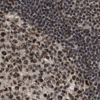 Immunohistochemistry-Paraffin: PRPF4 Antibody [NBP1-83217] - Staining of human lymph node.