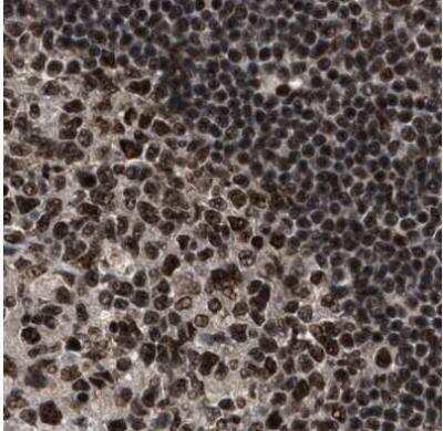 Immunohistochemistry-Paraffin: PRPF4 Antibody [NBP1-83218] - Staining of human lymph node using Anti-PRPF4 antibody.