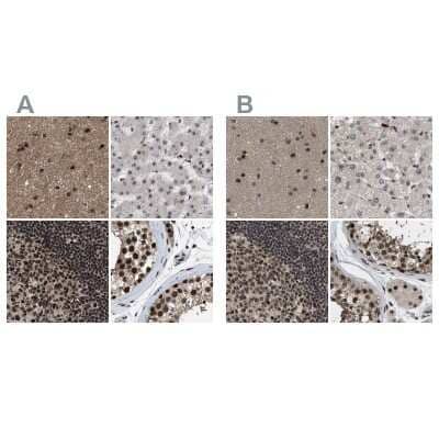 Immunohistochemistry-Paraffin: PRPF4 Antibody [NBP1-83218] - Staining of human cerebral cortex, liver, lymph node and testis using Anti-PRPF4 antibody NBP1-83218 (A) shows similar protein distribution across tissues to independent antibody NBP1-83217 (B).