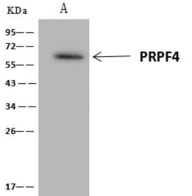 Immunoprecipitation: PRPF4 Antibody [NBP3-12635] - Lane A:0.5 mg 293 Whole Cell Lysate4 uL anti-PRPF4 rabbit polyclonal antibody and 60 ug of Immunomagnetic beads Protein A/G.Primary antibody:Anti-PRPF4 rabbit polyclonal antibody,at 1:100 dilution Secondary antibody:Clean-Blot IP Detection Reagent (HRP) at 1:1000dilutionDeveloped using the ECL technique.Performed under reducing conditions.Predicted band size: 58 kDaObserved band size :58 kDa