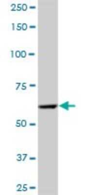 Western Blot: PRPF4 Antibody [H00009128-B01P] - Analysis of PRPF4 expression in human spleen.