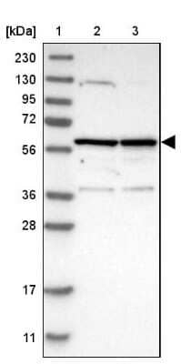 Western Blot: PRPF4 Antibody [NBP1-83217] - Lane 1: Marker  [kDa] 230, 130, 95, 72, 56, 36, 28, 17, 11.  Lane 2: Human cell line RT-4.  Lane 3: Human cell line U-251MG