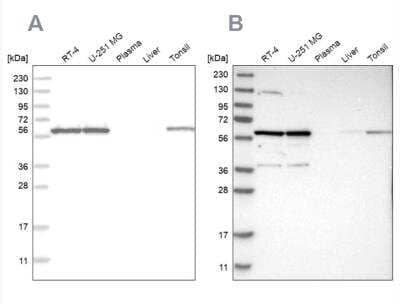 <b>Independent Antibodies Validation. </b>Western Blot: PRPF4 Antibody [NBP1-83218] - Analysis using Anti-PRPF4 antibody NBP1-83218 (A) shows similar pattern to independent antibody NBP1-83217 (B).