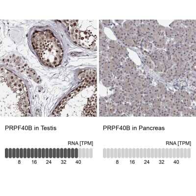 <b>Orthogonal Strategies Validation. </b>Immunohistochemistry-Paraffin: PRPF40B Antibody [NBP1-93679] - Staining in human testis and pancreas tissues using anti-PRPF40B antibody. Corresponding PRPF40B RNA-seq data are presented for the same tissues.