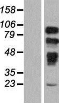 Western Blot: PRPF40B Overexpression Lysate (Adult Normal) [NBP2-08588] Left-Empty vector transfected control cell lysate (HEK293 cell lysate); Right -Over-expression Lysate for PRPF40B.