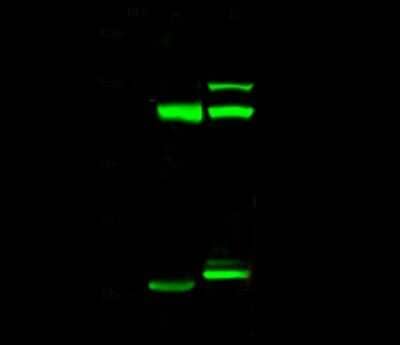 Western Blot: PRPF6 Antibody [NBP2-99184] - Anti-PRPF6 rabbit polyclonal antibody at 1:500 dilution. Lane A: HeLa Whole Cell Lysate. Lane B: Jurkat Whole Cell Lysate. Lysates/proteins at 30 ug per lane. Secondary Goat Anti- Rabbit IgG H&L (Dylight 800) at 1/10000 dilution. Developed using the Odyssey technique. Performed under reducing conditions. Predicted band size: 107 kDa. Observed band size: 119 kDa (We are unsure as to the identity of these extra bands).
