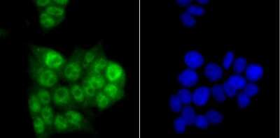 Immunocytochemistry/Immunofluorescence: PRPF8 Antibody (JG57-38) [NBP2-75630] - Staining PRPF8 in 293T cells (green). The nuclear counter stain is DAPI (blue). Cells were fixed in paraformaldehyde, permeabilised with 0.25% Triton X100/PBS.