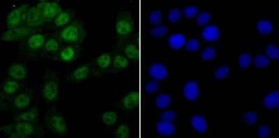 Immunocytochemistry/Immunofluorescence: PRPF8 Antibody (JG57-38) [NBP2-75630] - Staining PRPF8 in LOVO cells (green). The nuclear counter stain is DAPI (blue). Cells were fixed in paraformaldehyde, permeabilised with 0.25% Triton X100/PBS.