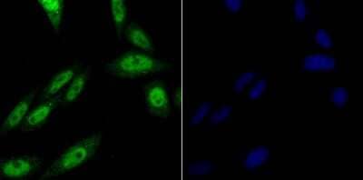 Immunocytochemistry/Immunofluorescence: PRPF8 Antibody (JG57-38) [NBP2-75630] - Staining PRPF8 in SiHa cells (green). The nuclear counter stain is DAPI (blue). Cells were fixed in paraformaldehyde, permeabilised with 0.25% Triton X100/PBS.