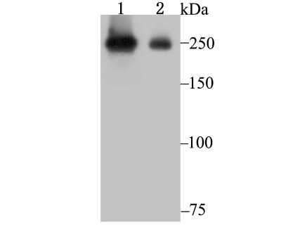 Western Blot: PRPF8 Antibody (JG57-38) [NBP2-75630] - Analysis of PRPF8 on SiHa (1)  and A549 (2) cell lysate using anti-PRPF8 antibody at 1/1,000 dilution.