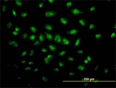 Immunocytochemistry/Immunofluorescence: PRPK Antibody (2A9) [H00112858-M02] - Analysis of monoclonal antibody to TP53RK on HeLa cell. Antibody concentration 10 ug/ml.