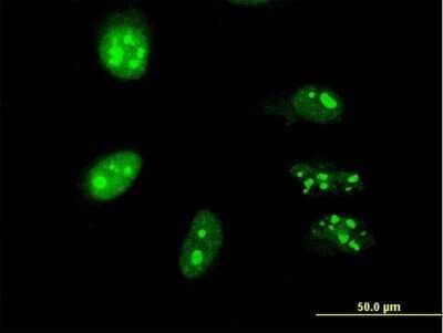 Immunocytochemistry/Immunofluorescence: PRPK Antibody (2E10) [H00112858-M05] - Analysis of monoclonal antibody to TP53RK on HeLa cell. Antibody concentration 10 ug/ml