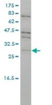 Western Blot: PRPK Antibody (4B9-1H3) [H00112858-M01] - TP53RK monoclonal antibody (M01), clone 4B9-1H3 Analysis of TP53RK expression in Jurkat.