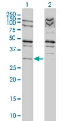 Western Blot: PRPK Antibody (4B9-1H3) [H00112858-M01] - Analysis of TP53RK expression in transfected 293T cell line by TP53RK monoclonal antibody (M01), clone 4B9-1H3.Lane 1: TP53RK transfected lysate(28 KDa).Lane 2: Non-transfected lysate.