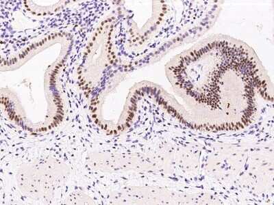 Immunohistochemistry-Paraffin: PRPK Antibody [NBP2-99394] - Immunochemical staining of human PRPK in human gallbladder with rabbit polyclonal antibody at 1:500 dilution, formalin-fixed paraffin embedded sections.