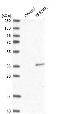 Western Blot: PRPK Antibody [NBP1-89919] - Analysis in control (vector only transfected HEK293T lysate) and TP53RK over-expression lysate (Co-expressed with a C-terminal myc-DDK tag (3.1 kDa) in mammalian HEK293T cells).