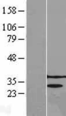 Western Blot: PRPK Overexpression Lysate (Adult Normal) [NBL1-17207] Left-Empty vector transfected control cell lysate (HEK293 cell lysate); Right -Over-expression Lysate for PRPK.