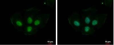 Immunocytochemistry/Immunofluorescence: PRPS1L1 Antibody [NBP1-33410] - NT2D1 cells were fixed in 4% paraformaldehyde at RT for 15 min. Green: PRPS1L1 protein stained by PRPS1L1 antibody diluted at 1:500. Blue: Hoechst 33342 staining.Scale bar = 10 um.